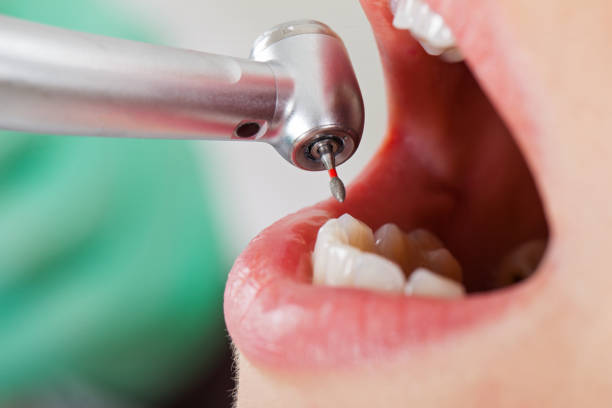 Best Emergency Gum Treatment in Kingsville, MD
